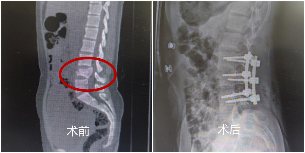 术前术后对比