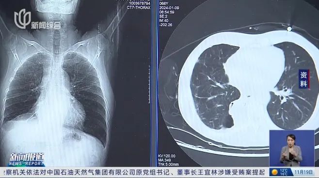 买重疾险后确诊癌症! 这个细节竟成拒赔理由……法院判了→