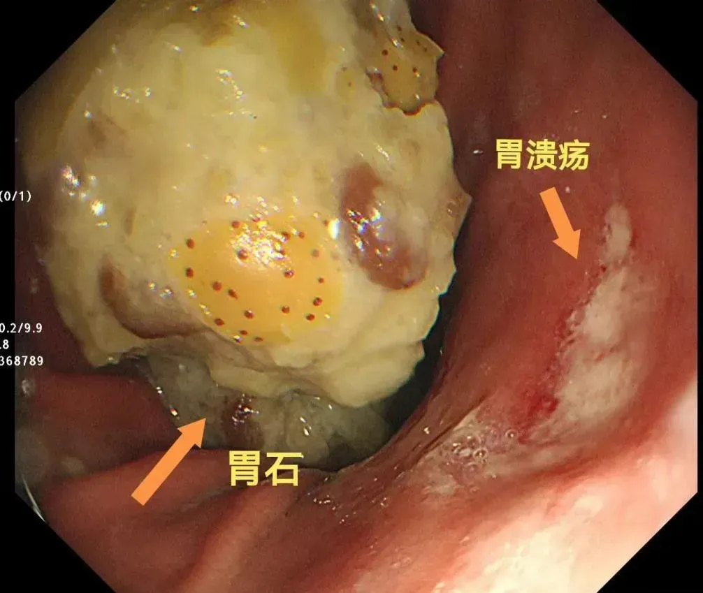 山姆又出事？有人“趴在马桶边度过后半夜”！最新：已添加提醒