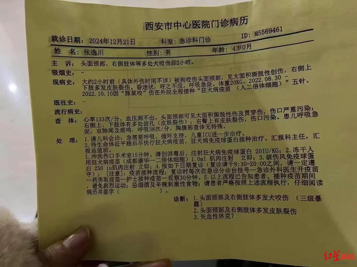 西安4岁男童遭恶犬袭击，致脸部大面积创伤，目前仍在ICU昏迷 警方已在调查犬只来源