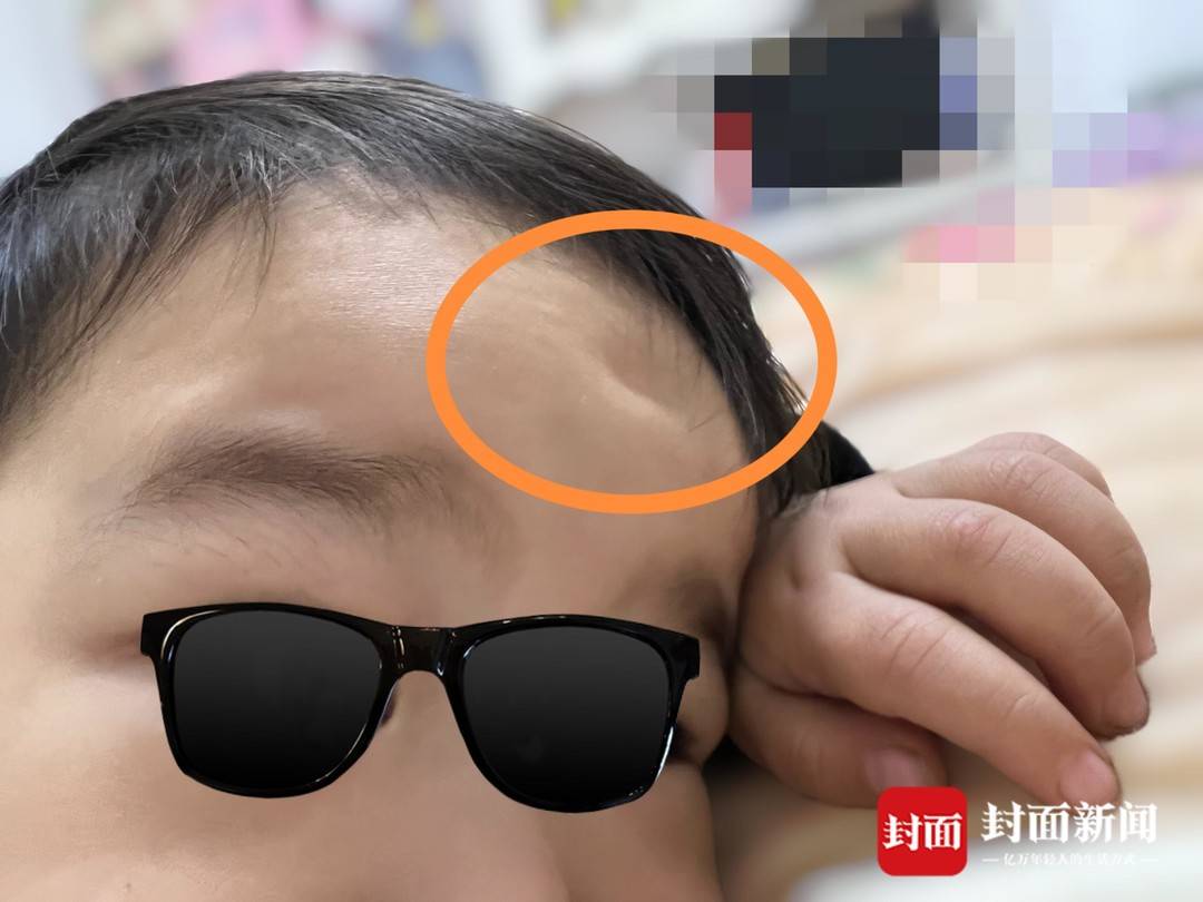 宜宾一幼童在早教课上摔伤致十级伤残 机构拒绝“私了”：不认可司法鉴定，希望走法律程序