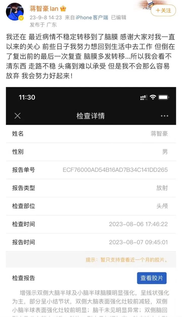 28岁男艺人确诊肺癌晚期，已大面积转移！最新发声