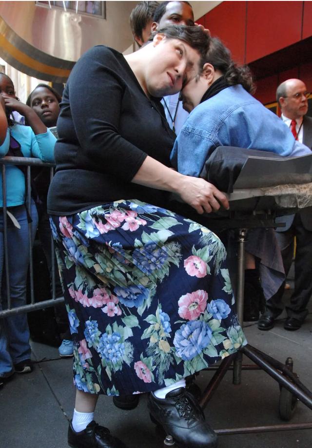 “世上最年长连体双胞胎”去世，终年62岁，死因未公开