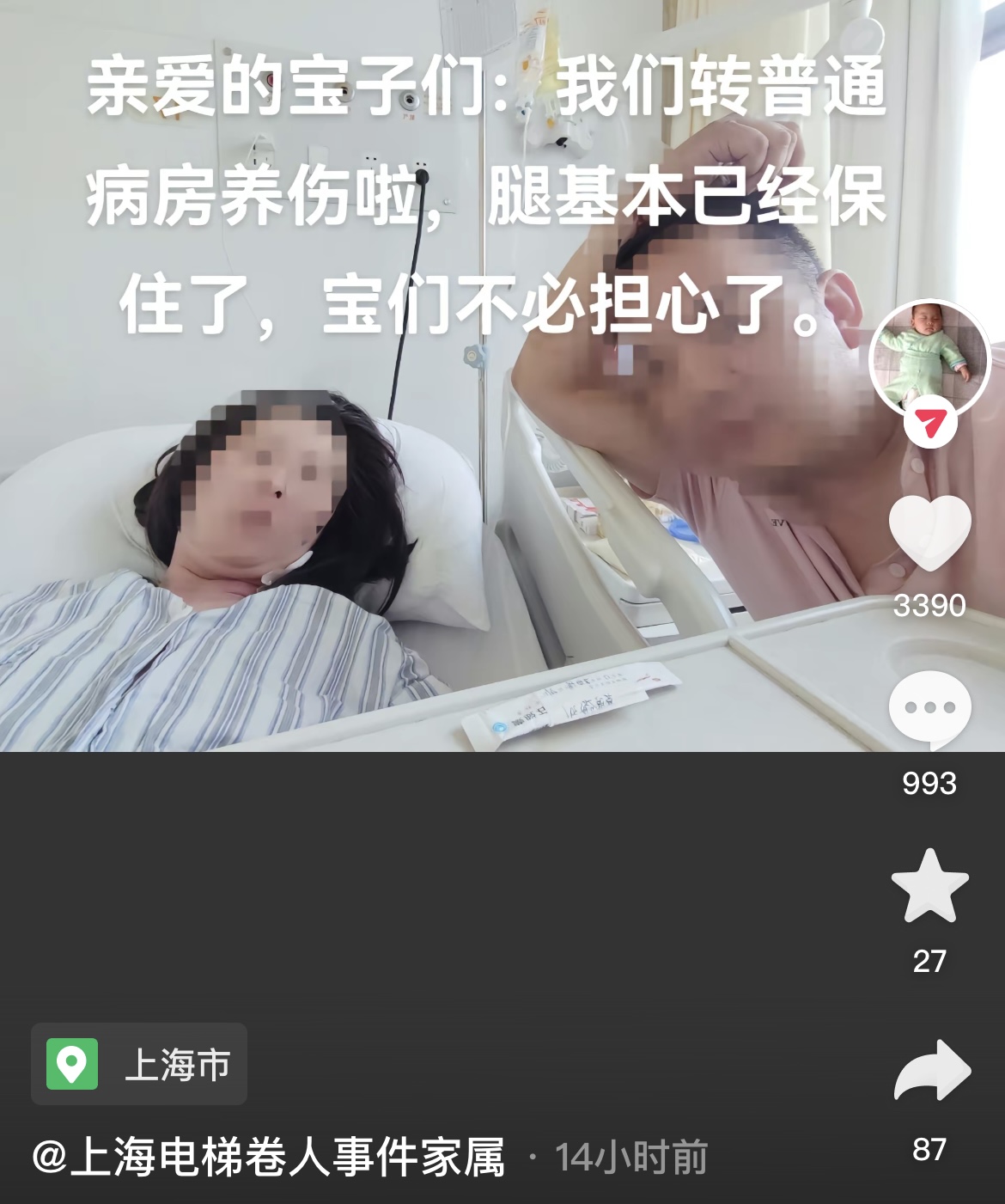 上海“扶梯卷人”事件伤者腿保住了，已转出ICU