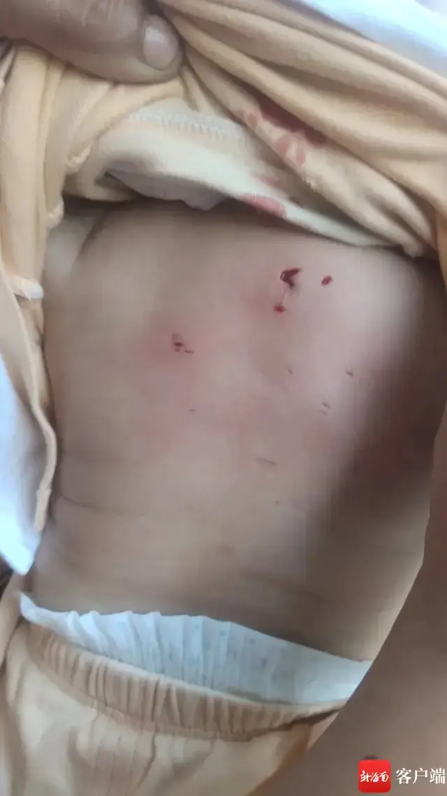 海南野猴进村伤人,还试图抓走婴儿!村支书:致9人受伤,包括6名小孩