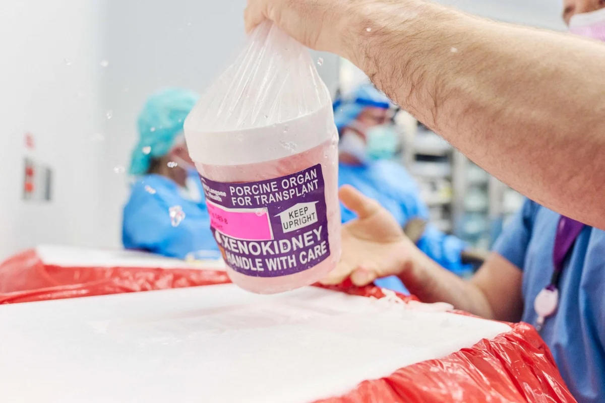 全球首例猪肾移植患者死亡,死因未公布 家人:他在人间多停留了7周