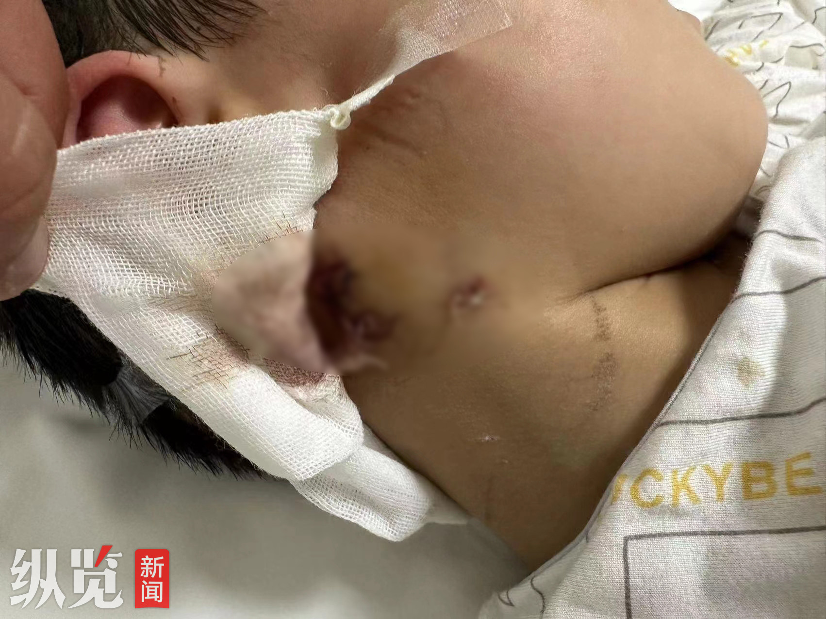 河南3岁男童被恶犬咬伤离世 母亲发声