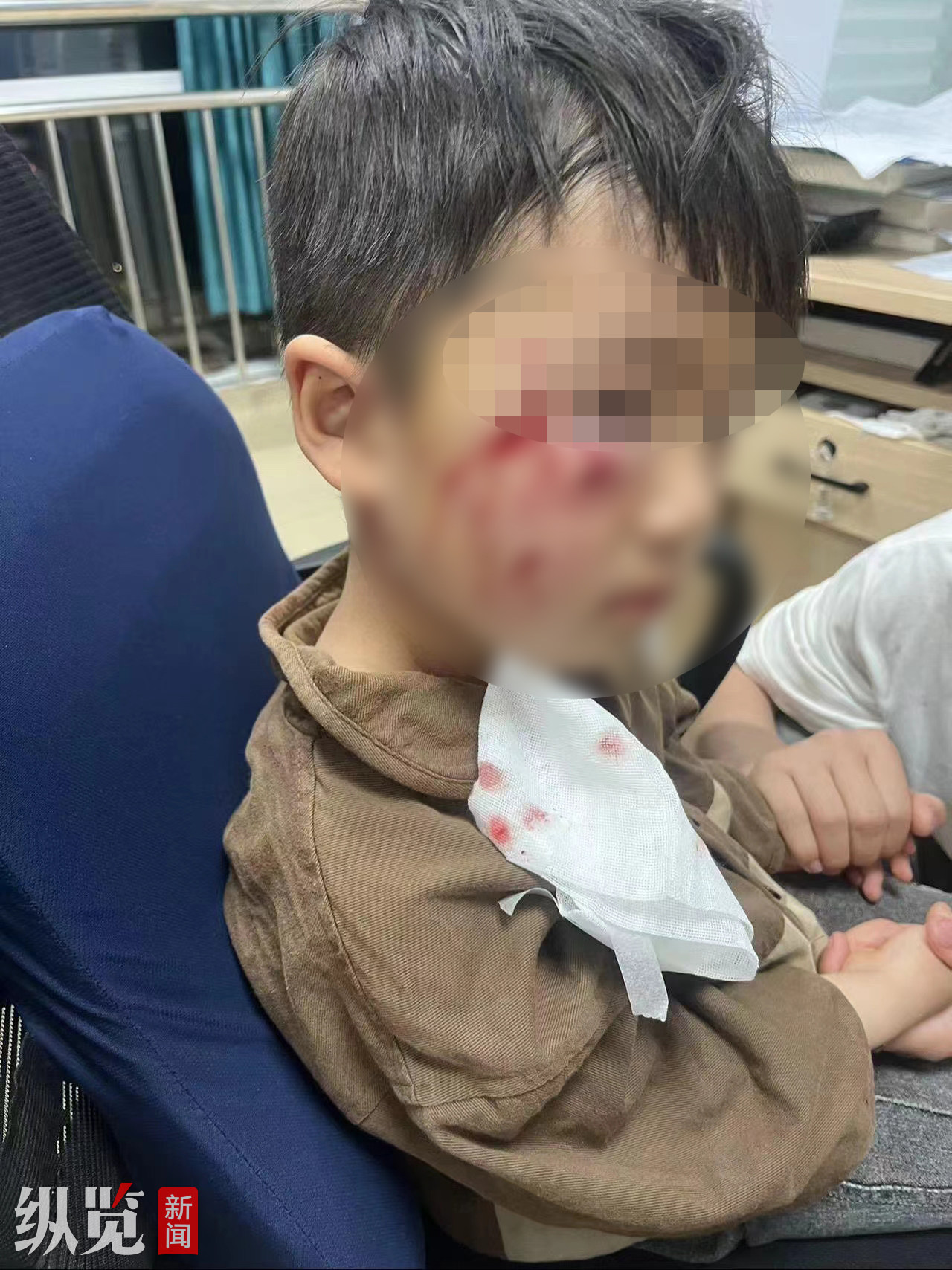 河南3岁男童被恶犬咬伤离世 母亲发声