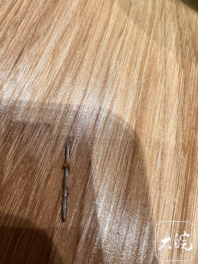 5岁孩子吃水饺狂哭不止 家长从门牙边拔出三四厘米长针头