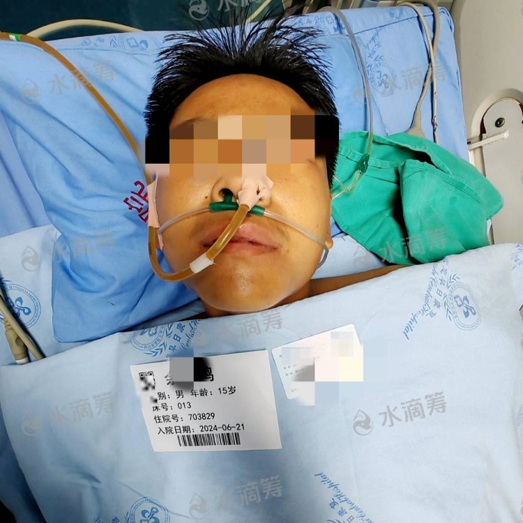 一家4口误食野生“鹅膏菌”中毒：1人身亡3人仍在救治，