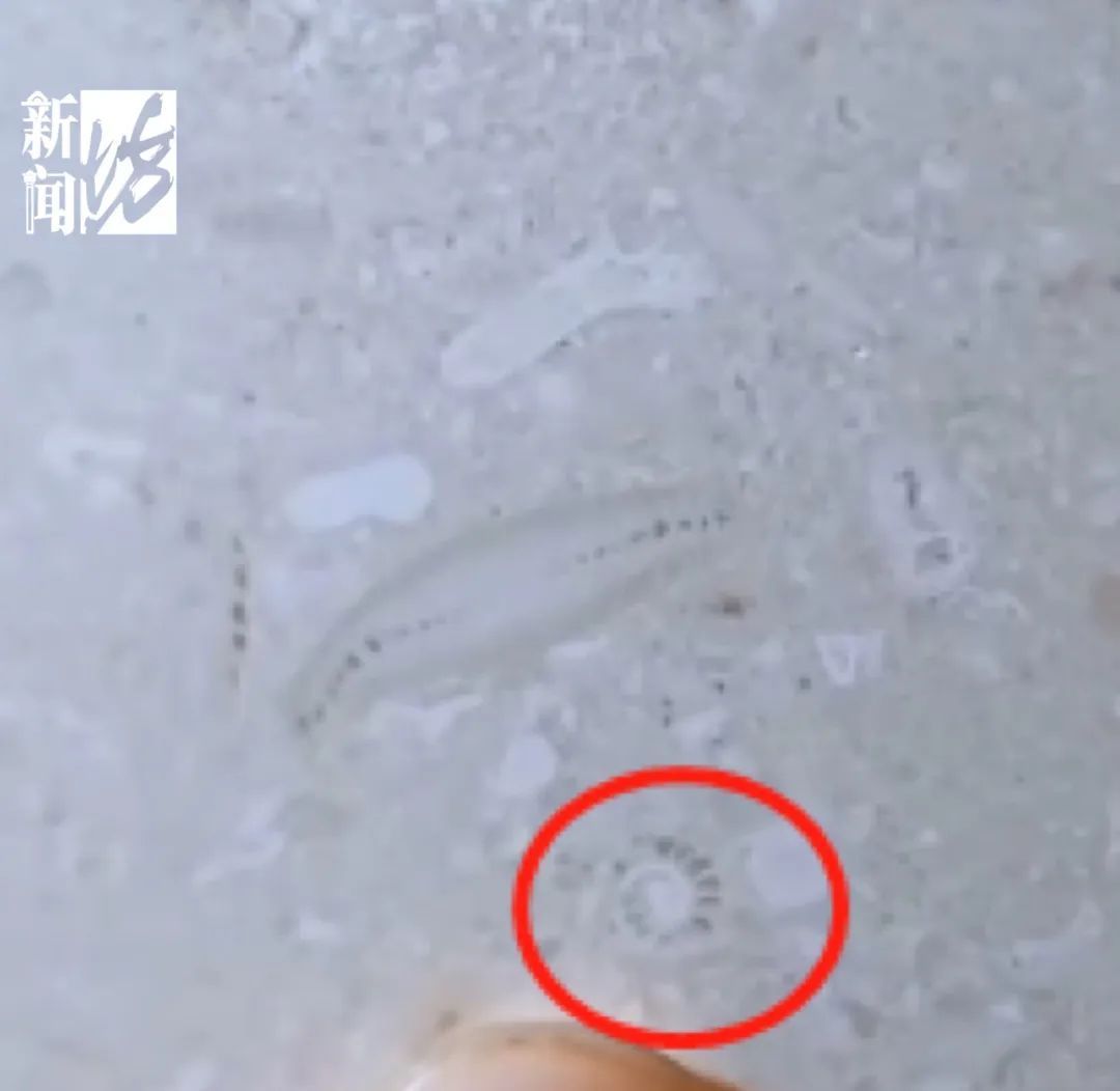 10岁小学生在瑞金医院发现上亿年前化石