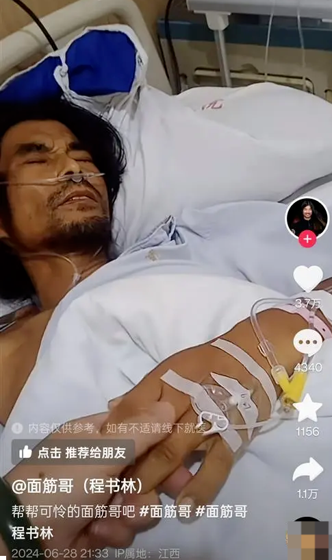 网红“面筋哥”突然晕倒被送ICU 女友:已转院至杭州,人依旧昏迷