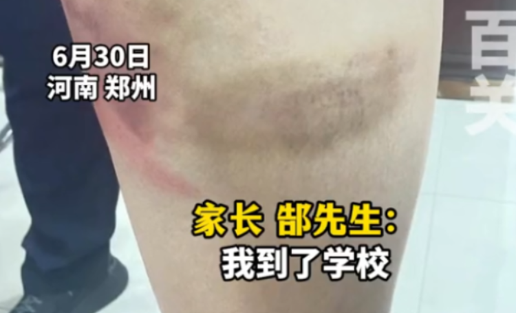 河南登封的武校“江湖”：曾发生多起学员死亡事件，当地多次整改