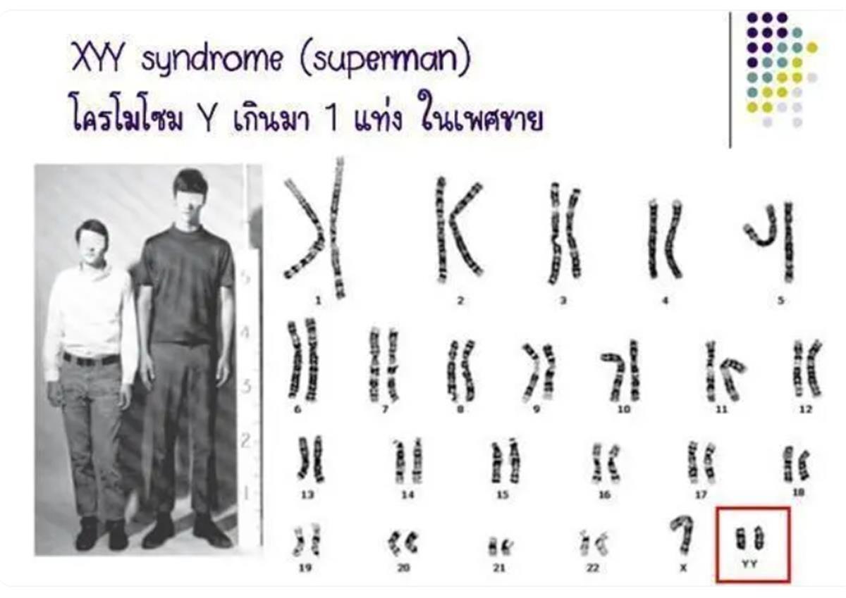 胎儿检出嵌合体超雄综合征引热议，医生：“天生坏种”的说法无科学依据