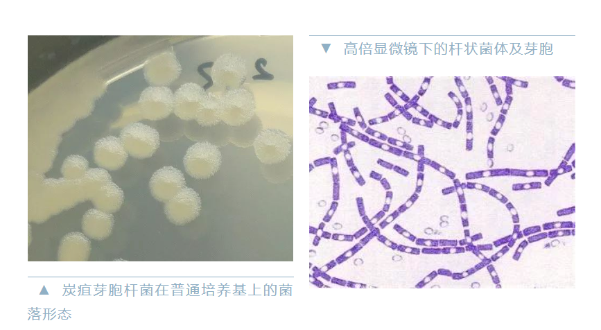 一地发现炭疽病例，5人被隔离治疗！如何预防？会发生人传人吗？