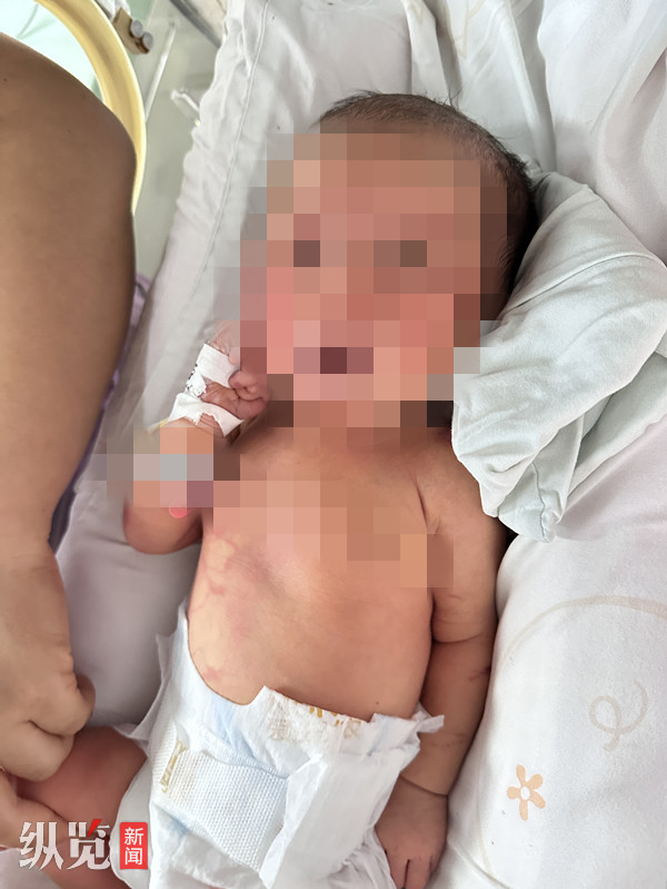 四川村民捡到脐带胎盘未剪婴儿被诊断出肺炎骨折 警方:已采集DNA ,以涉嫌遗弃罪立案