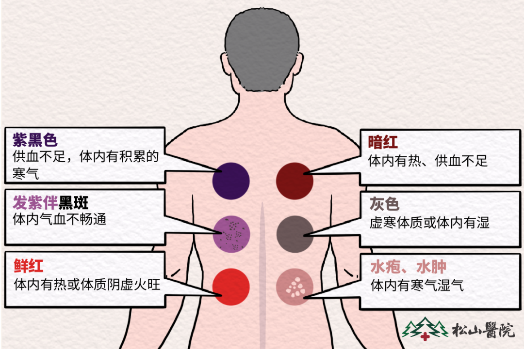 未命名图片