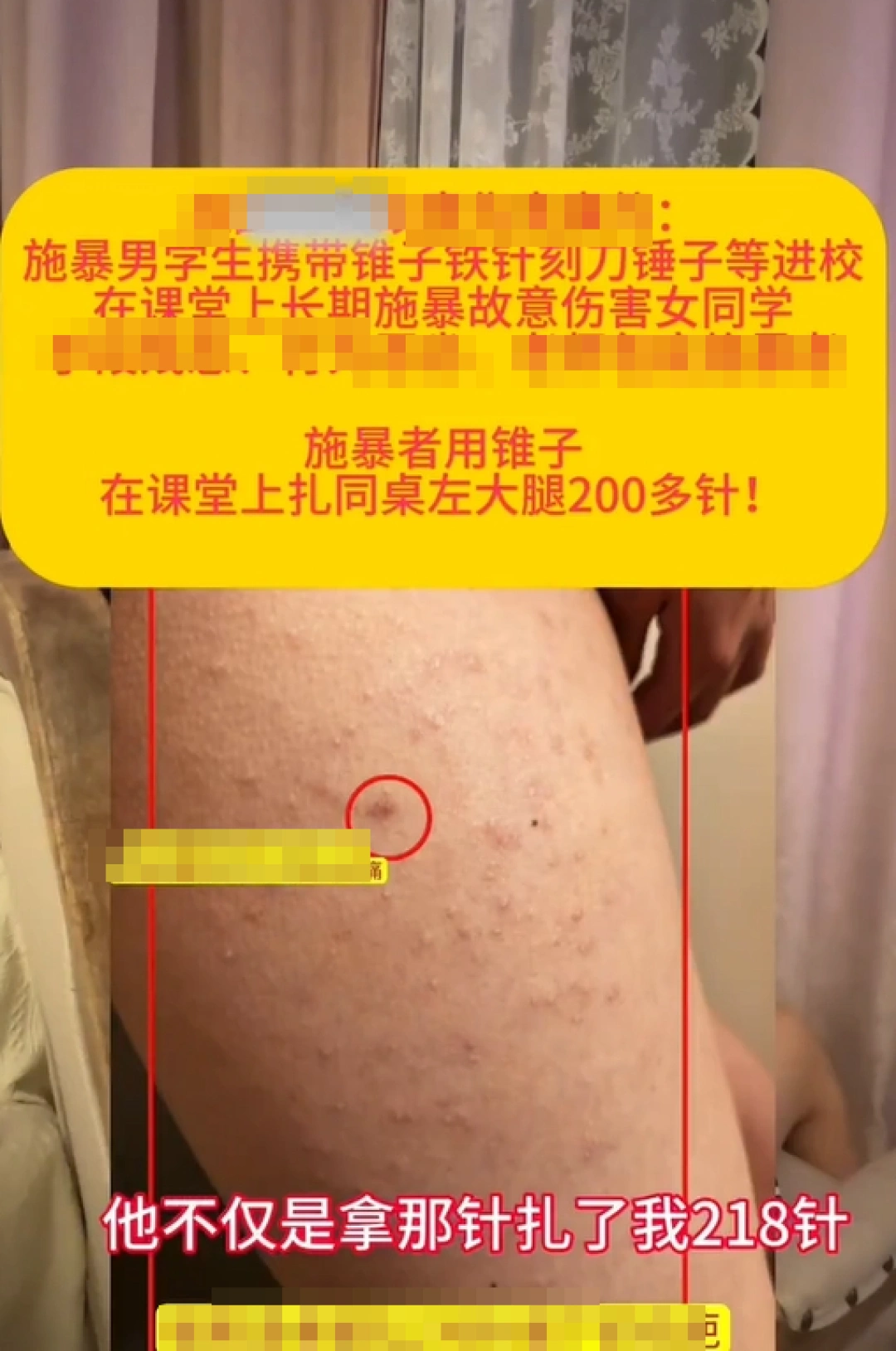 济南章丘一女生被同桌男生用铁锥扎数百下？教体局：事发半年前，副区长已带队调查