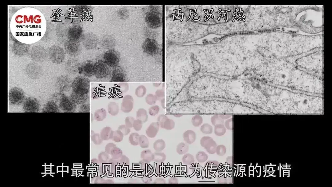 经常熬夜的20岁小伙被蚊子“叮”进ICU