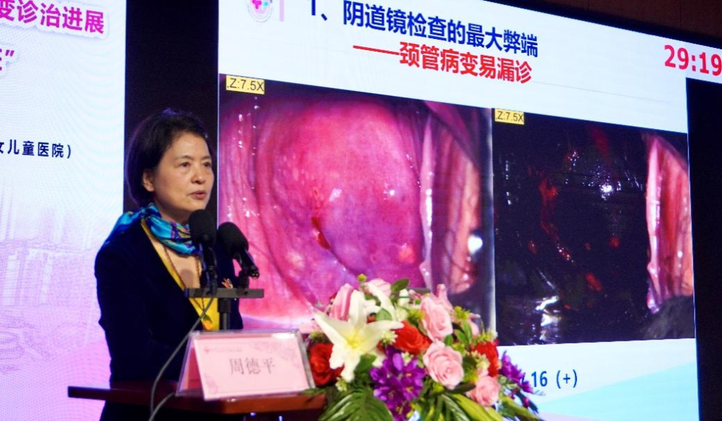 重庆市妇幼保健院周德平主任医师讲授《阴道镜诊断难点分析》