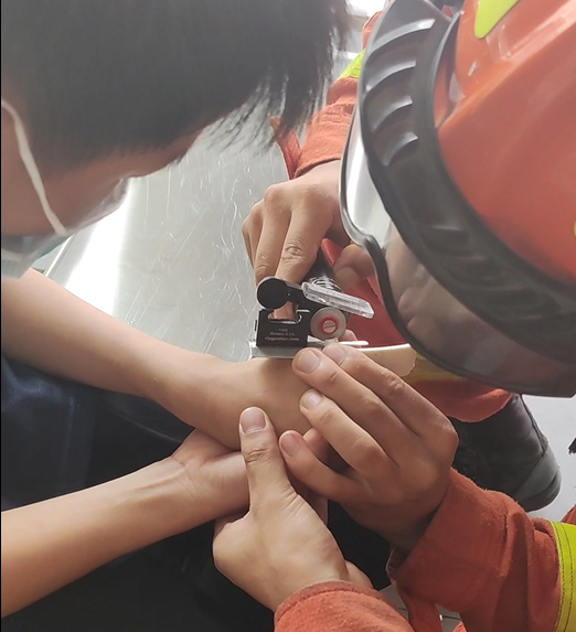 2消防员使用微型切割器对卡住手指的手柄部分进行小心切割。大足区消防供图