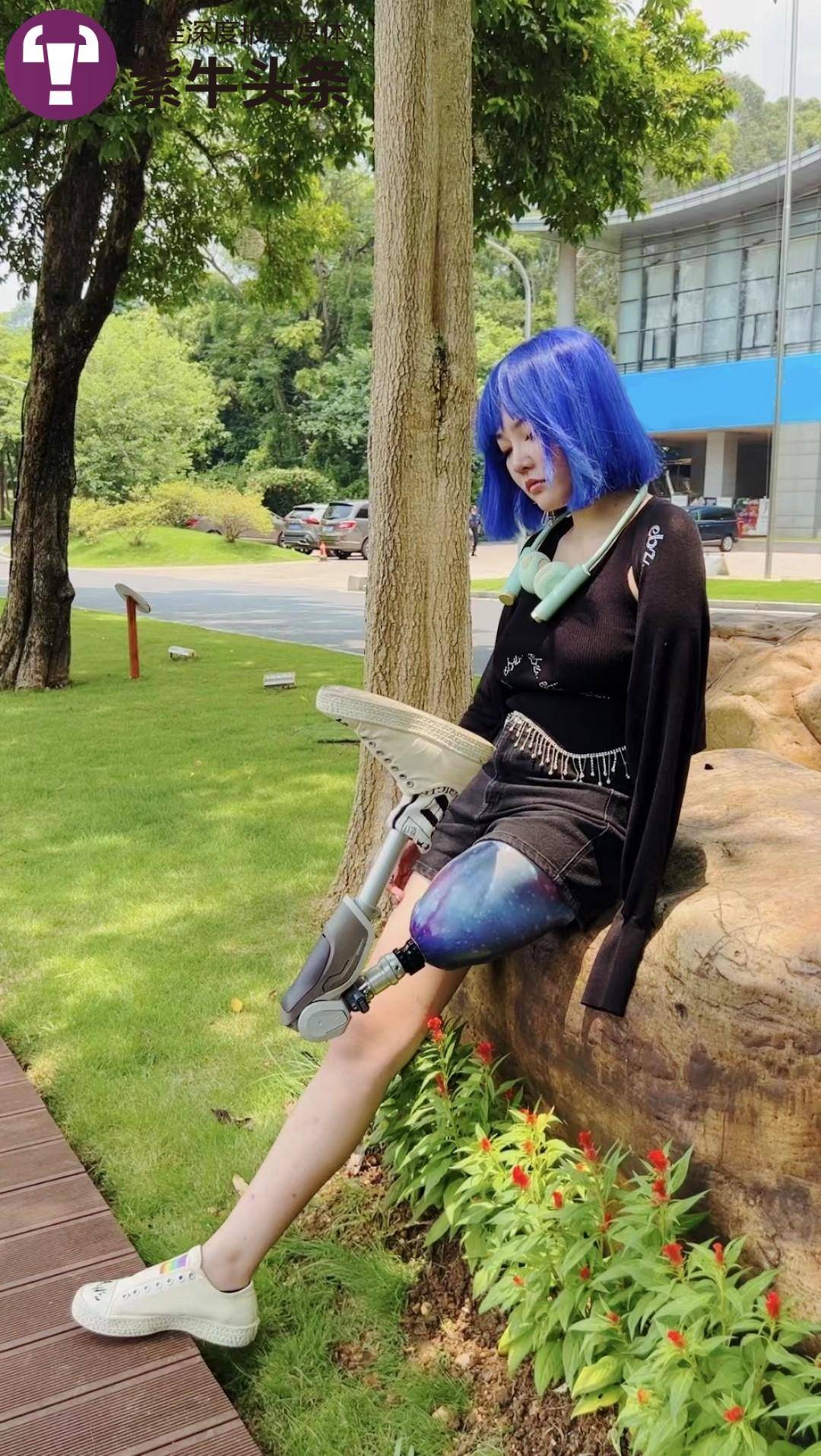 “不是谁都能追到我”，失去左臂左腿的95后女孩活出精彩“右侧人生”4