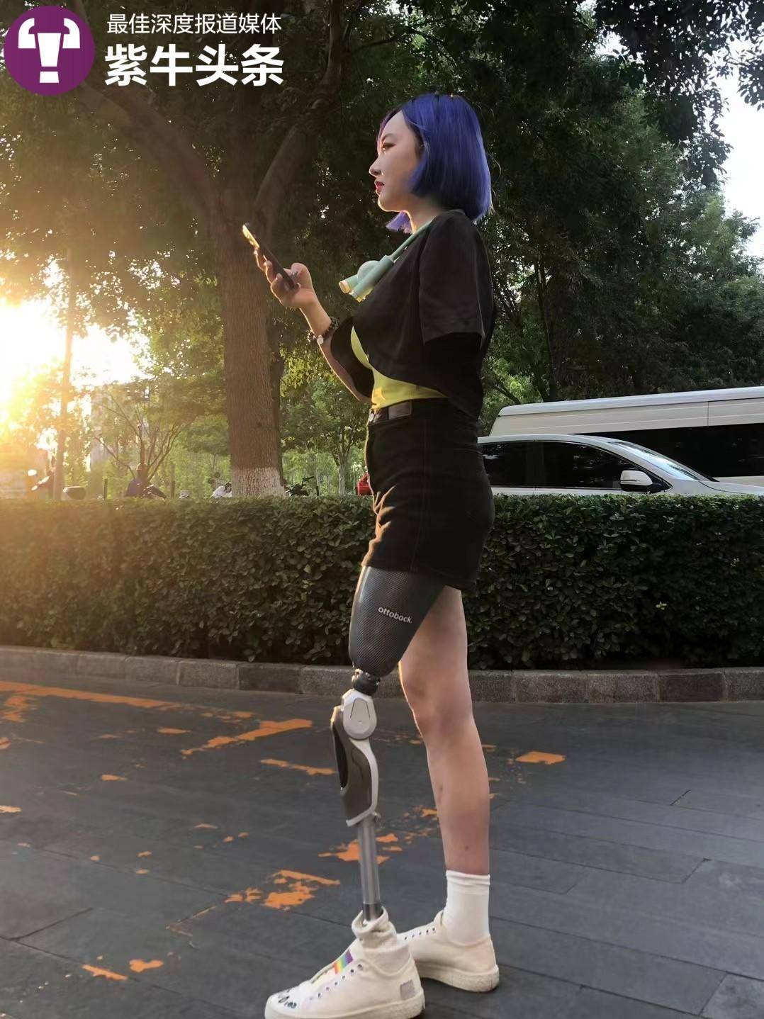 “不是谁都能追到我”，失去左臂左腿的95后女孩活出精彩“右侧人生”1