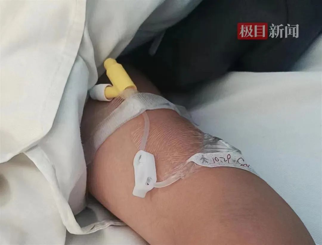 河北保定一学生屁股被老师打成黑紫色？涉事老师停课！3
