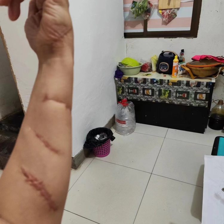 女孩被前男友追砍室友帮忙呼救也被砍20多刀，律师：女孩应适当补偿室友