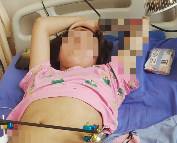 成都15岁少女KTV醉酒后从三楼坠落，鑫银汇KTV涉嫌组织未成年人有偿陪侍被刑事立案2