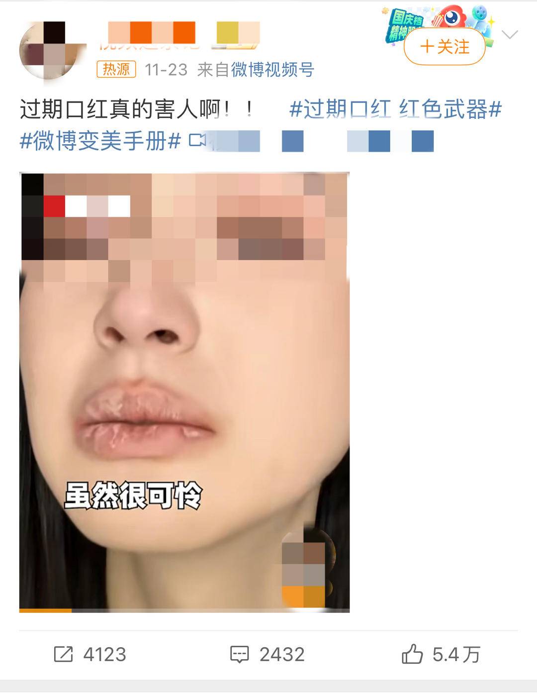 吵翻天！到底是因为口红过期还是劣质引发的唇炎？3