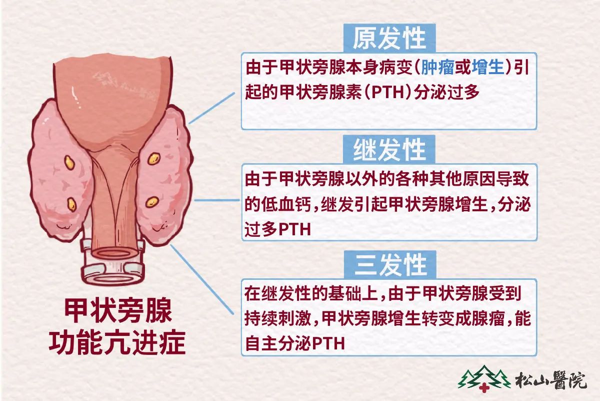 “搬运”甲状旁腺，解决肾病难题，这是甚么操作？