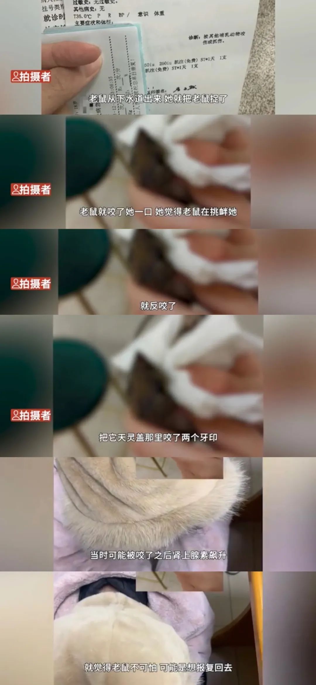 挑衅?女生被老鼠咬手,反咬报仇!室友:天灵盖上俩牙印 | 如何正确处理?专家提醒 →4