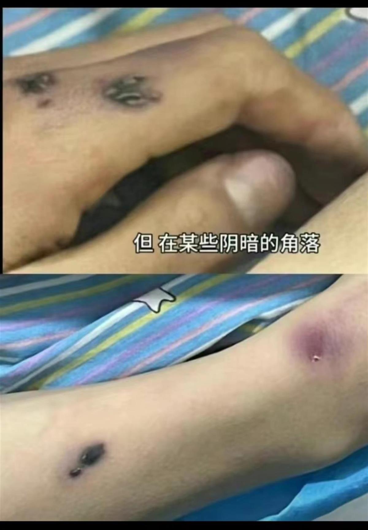 河南商丘一初中学生被虐待致死？教育局：不存在虐待情况，排除刑事案件