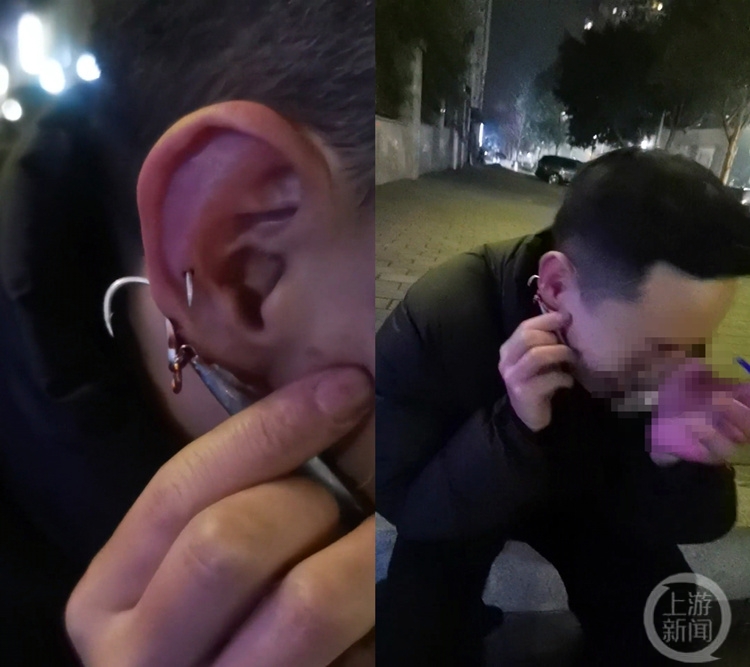 重庆一男子钓鱼勾住自己耳朵 网友:免费穿了个耳洞1