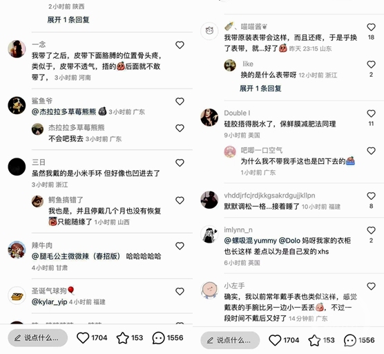 多人网曝戴苹果手表“手凹了” 客服：或与手表背后凸起有关，无影响2