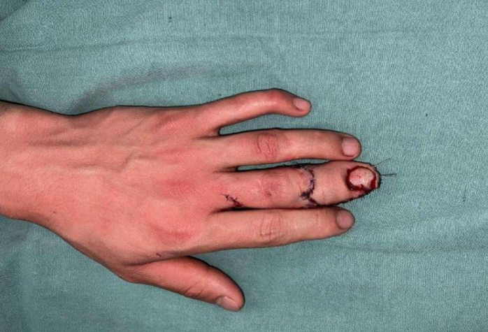 5
