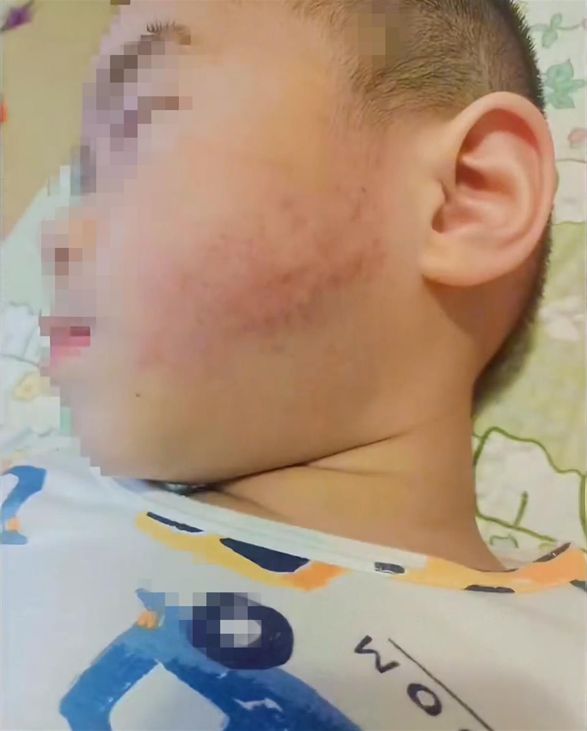 警方回应“幼儿园阿姨疑用棍子打小孩”:那是卷起来的报纸,多部门正在调查2