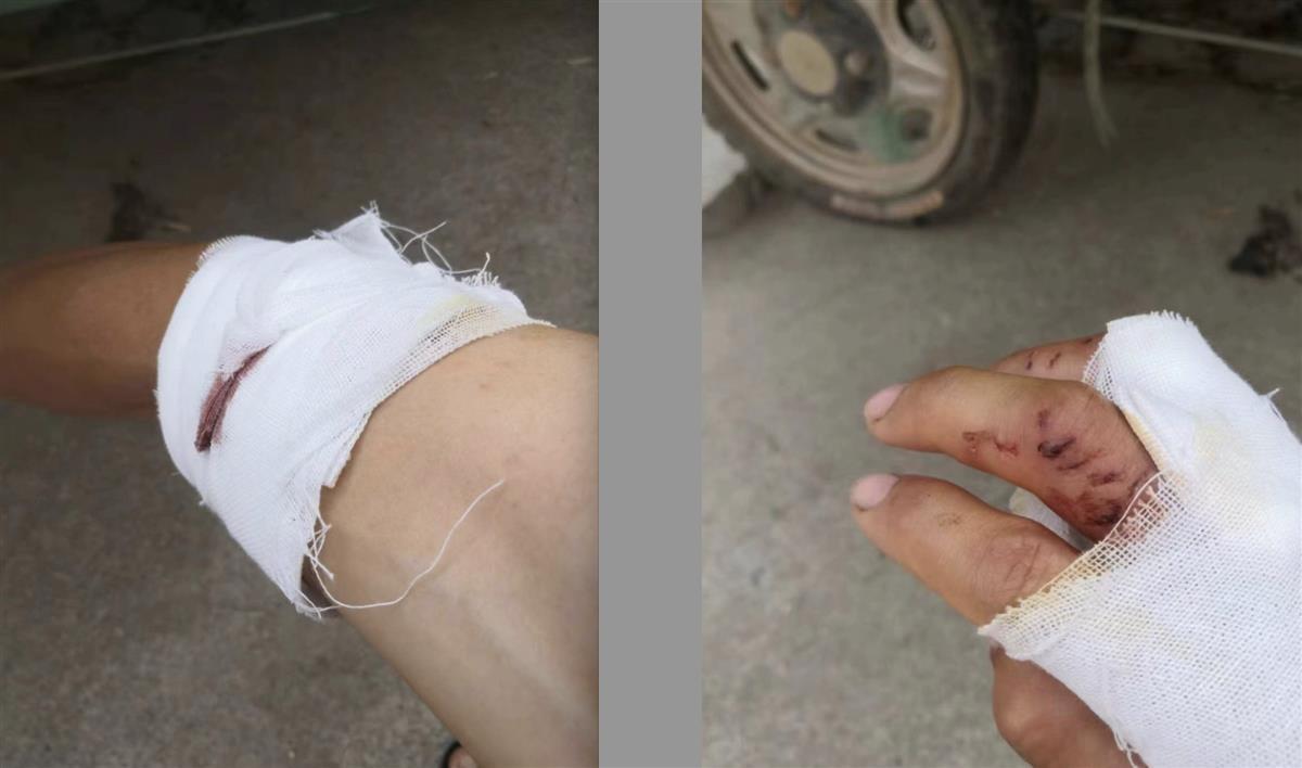 黑犬闯入店内欲接近十个月大婴儿,父亲为保护孩子被咬伤,家属:它还伤了一名七旬老太2