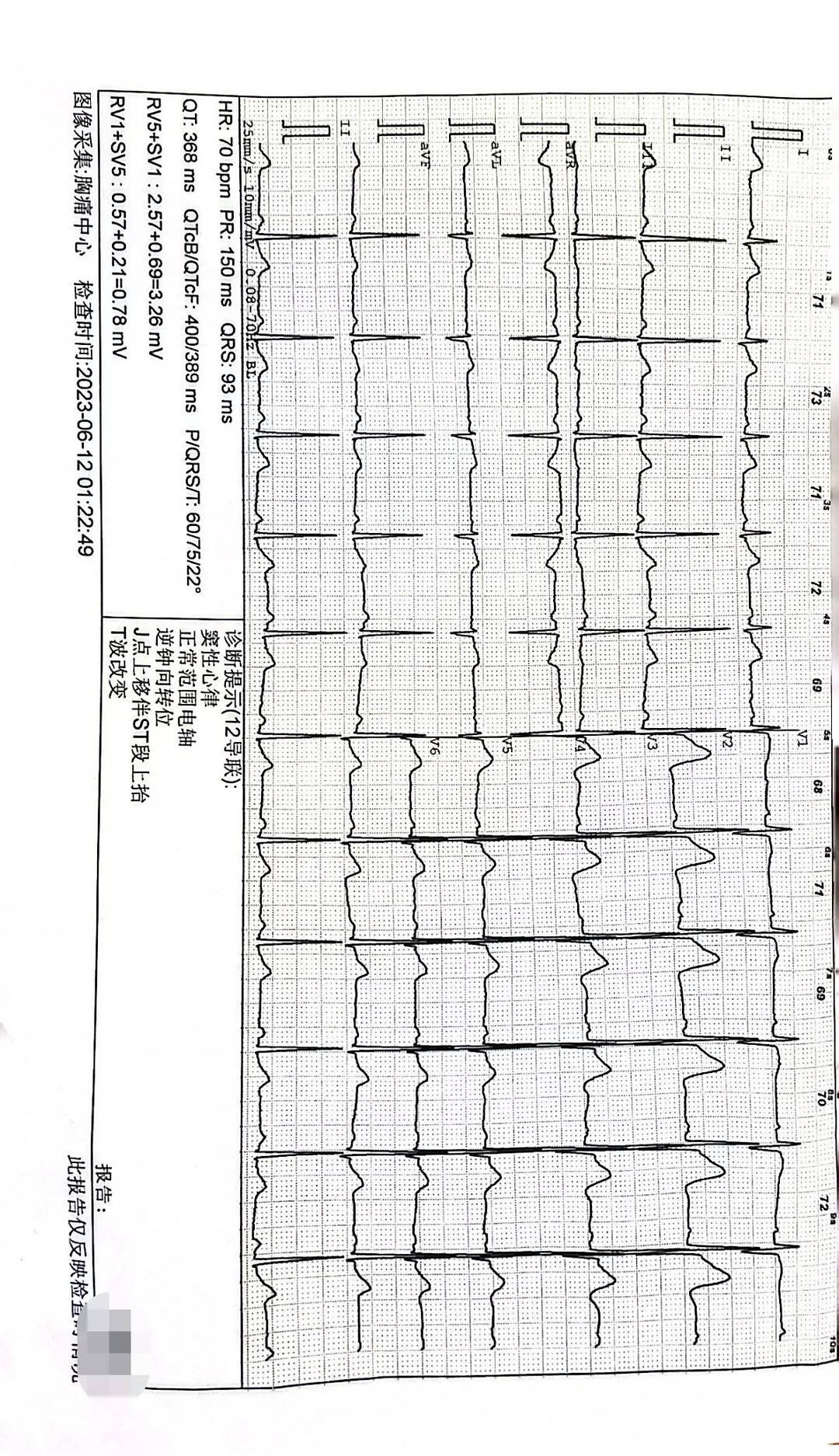 成齐地铁回答“被冤枉偷拍须眉决定告状维权”：每节车厢齐有监控，遇雷共事情提出报警3