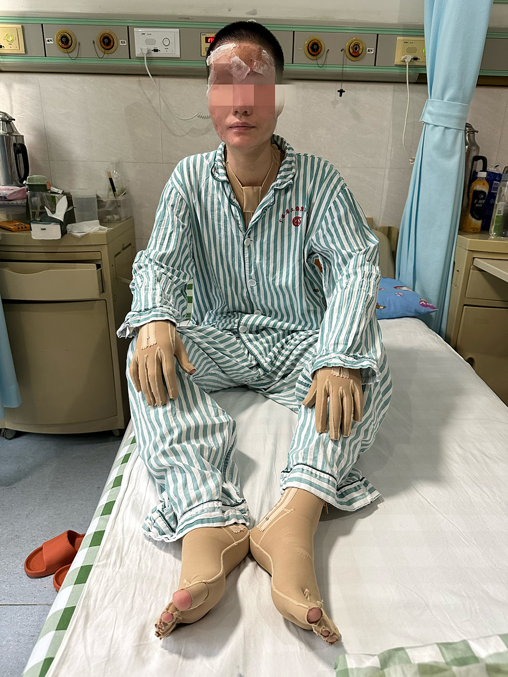 妻子称丈夫泼汽油致双双烧伤已获立案,男方亲属否认骗捐200余万4