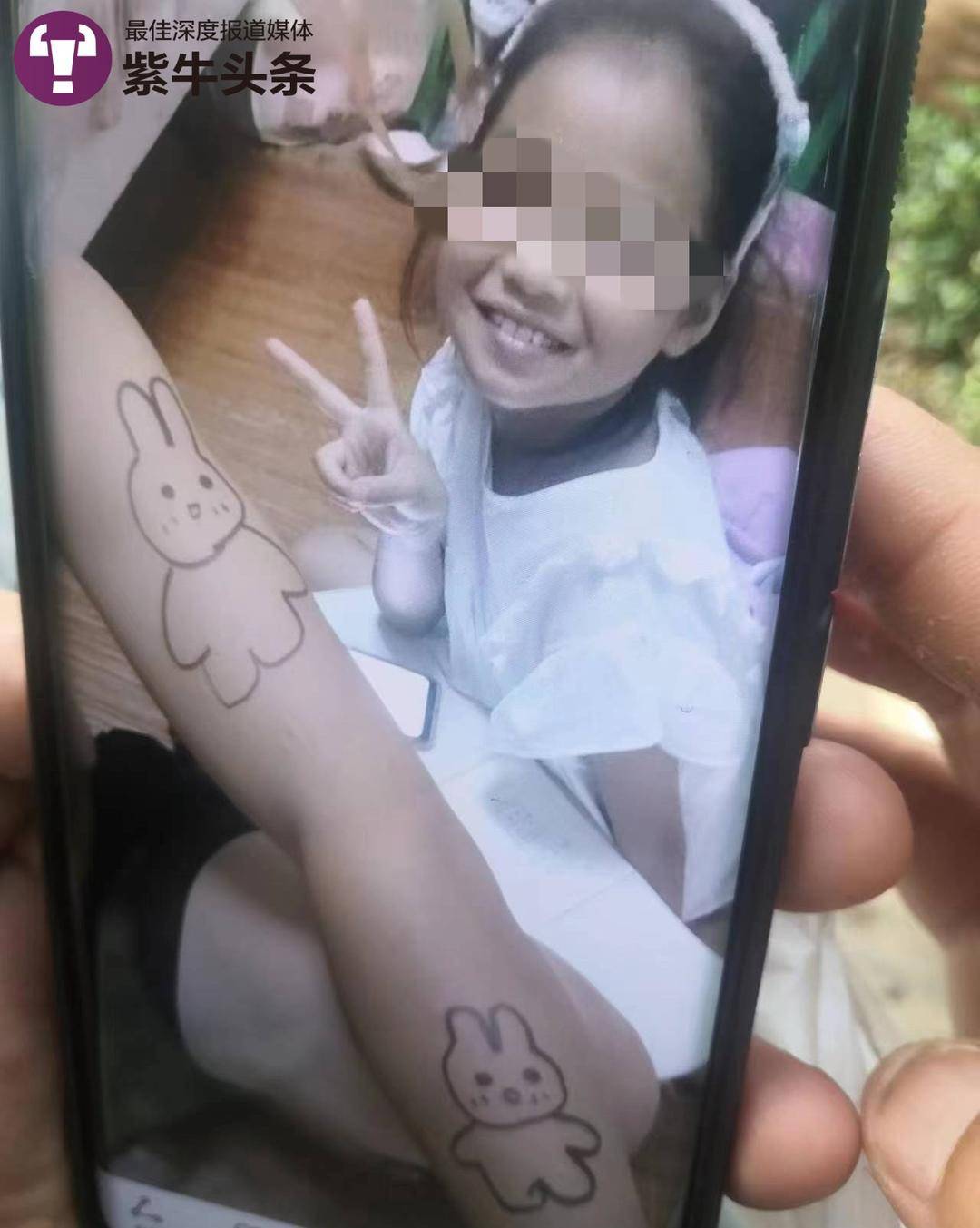8岁女童左眼被两男孩用钢珠射伤失明：妈妈，我的眼睛什么时候能好啊5