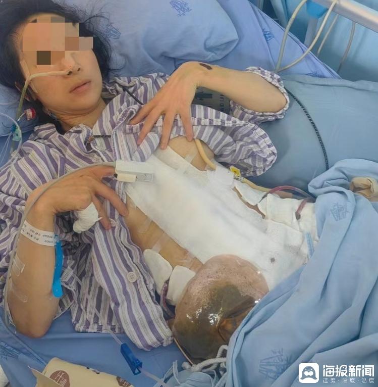 “女子两年被家暴16次”案已移交检察院 当事人：他真的是要杀我而不只是家暴3