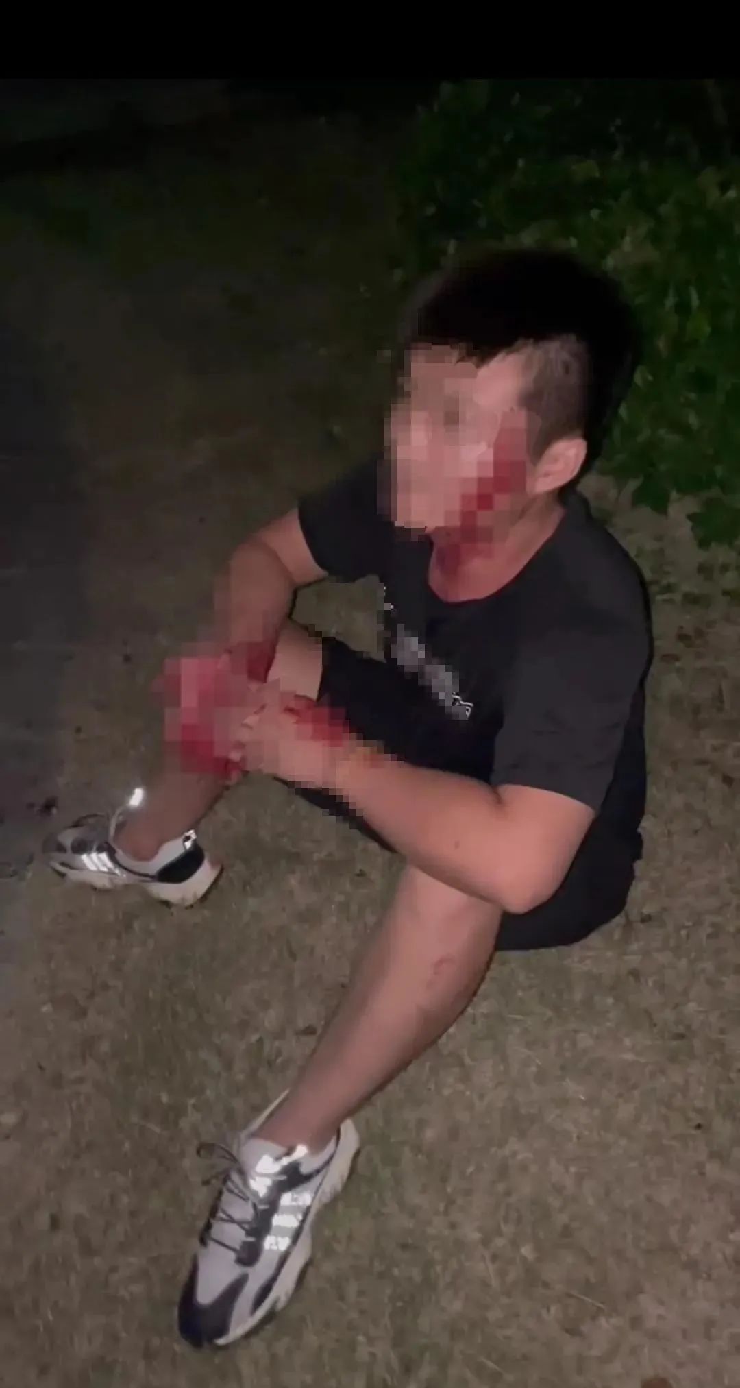 山东多名醉酒男子被一女子持刀砍伤？街道办：涉事女子已被带走1