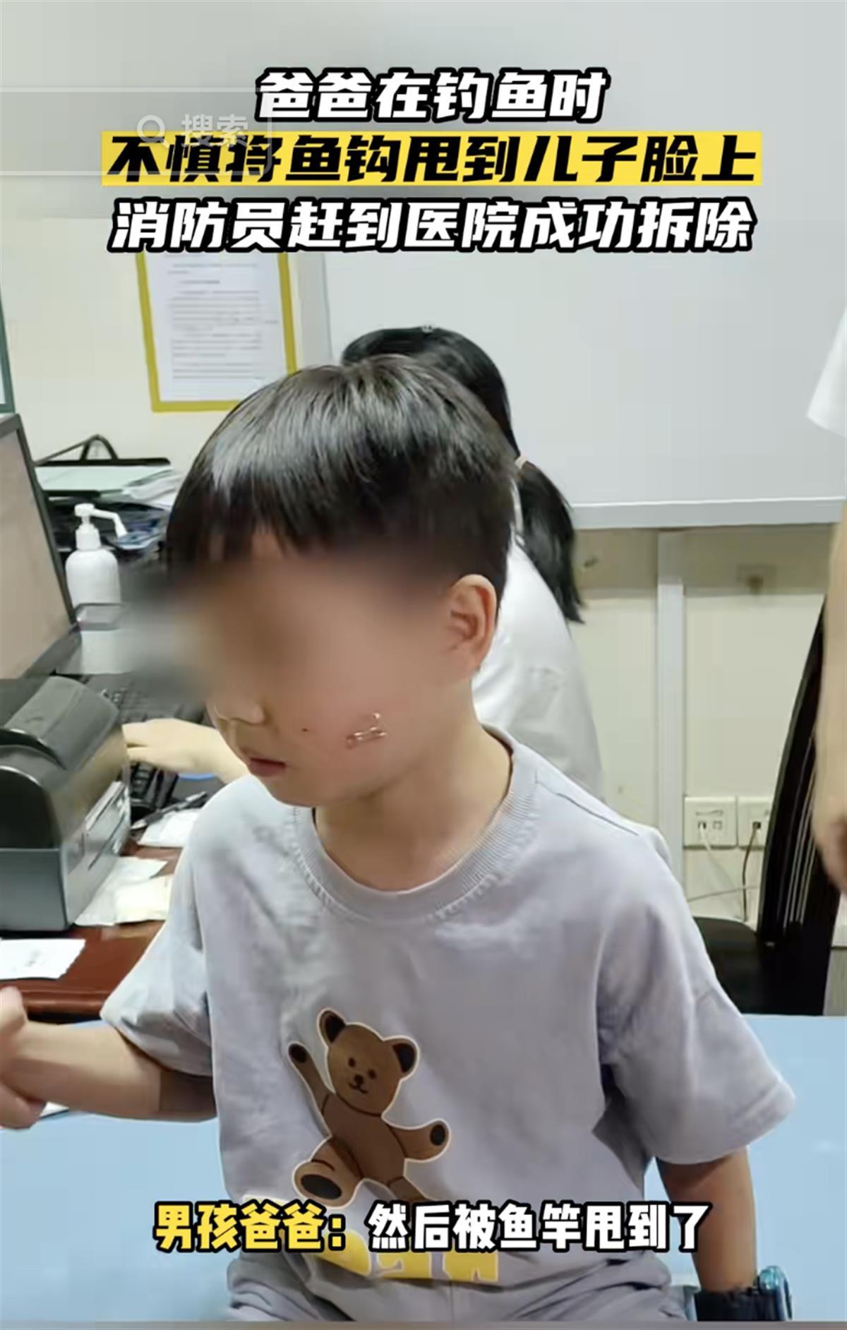 爸爸钓鱼不慎将鱼钩甩到8岁儿子脸上，消防赶到医院成功取下，网友：看着都疼2