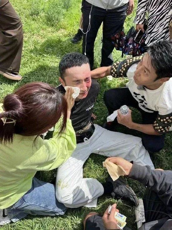 央视主持人尼格买提录节目时突发意外，撒贝宁在一旁协助处理伤口1