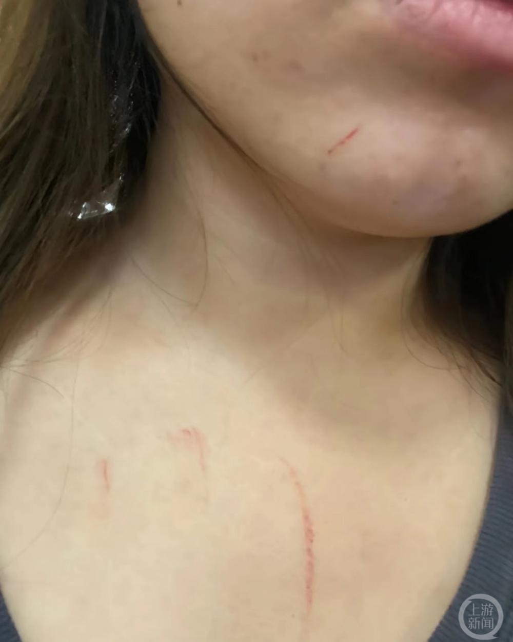 高铁拒换座被打女子：对方先动手1