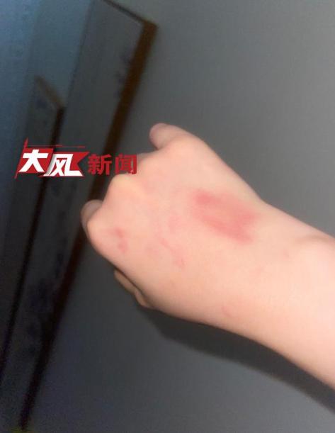 女子称遭夫妻俩殴打扒衣 只因狗尾巴扫到对方?警方展开调查2