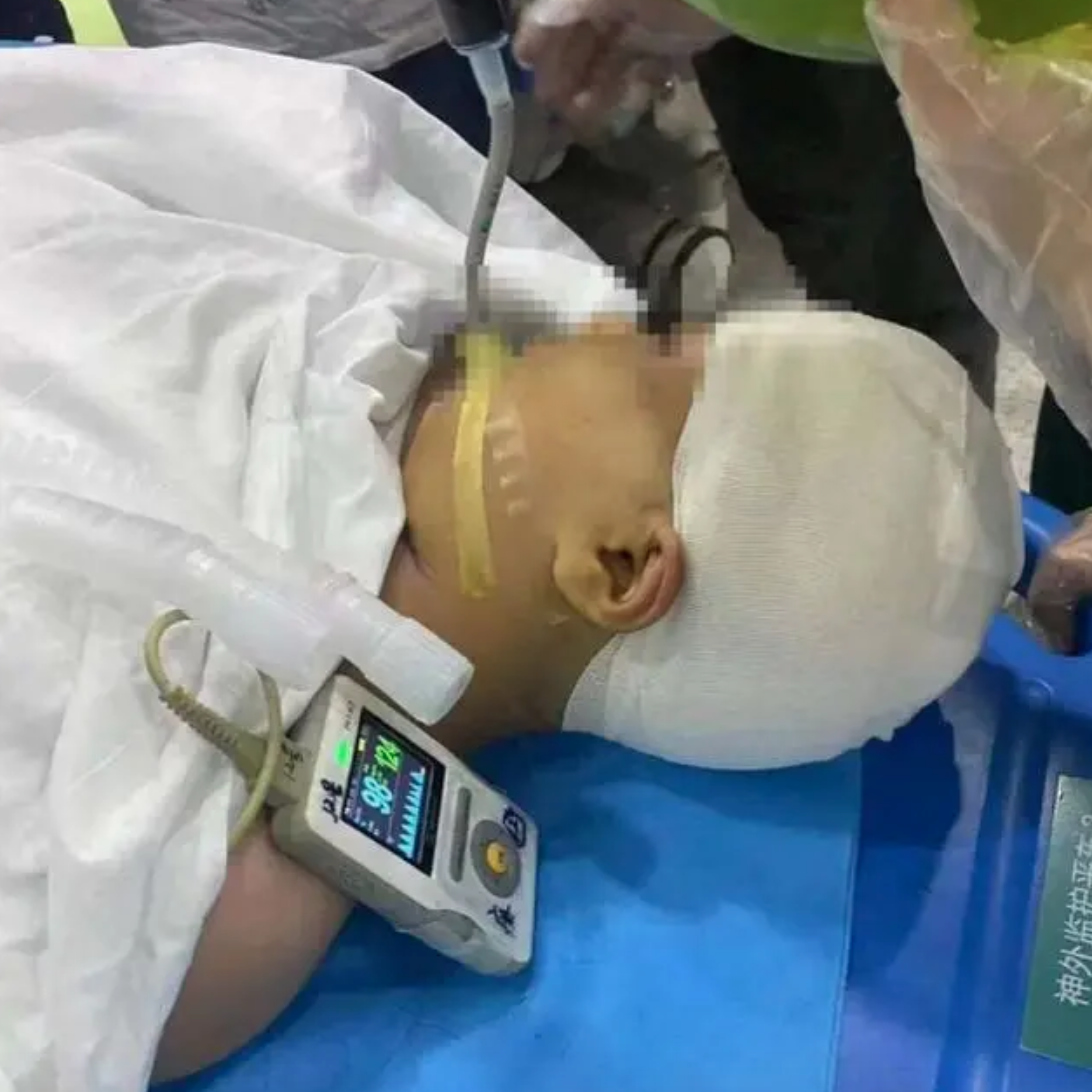 “老师钢尺打碎女生头盖骨”：当教师以“钢尺”服人时，便已铸成大祸 