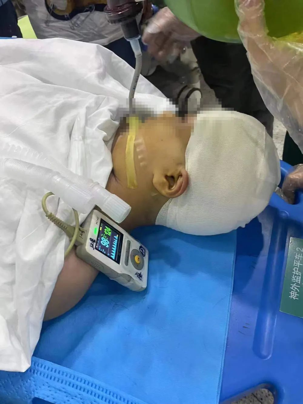 被老师打破头骨女孩已清醒，家属被告知当天监控无法调取！1